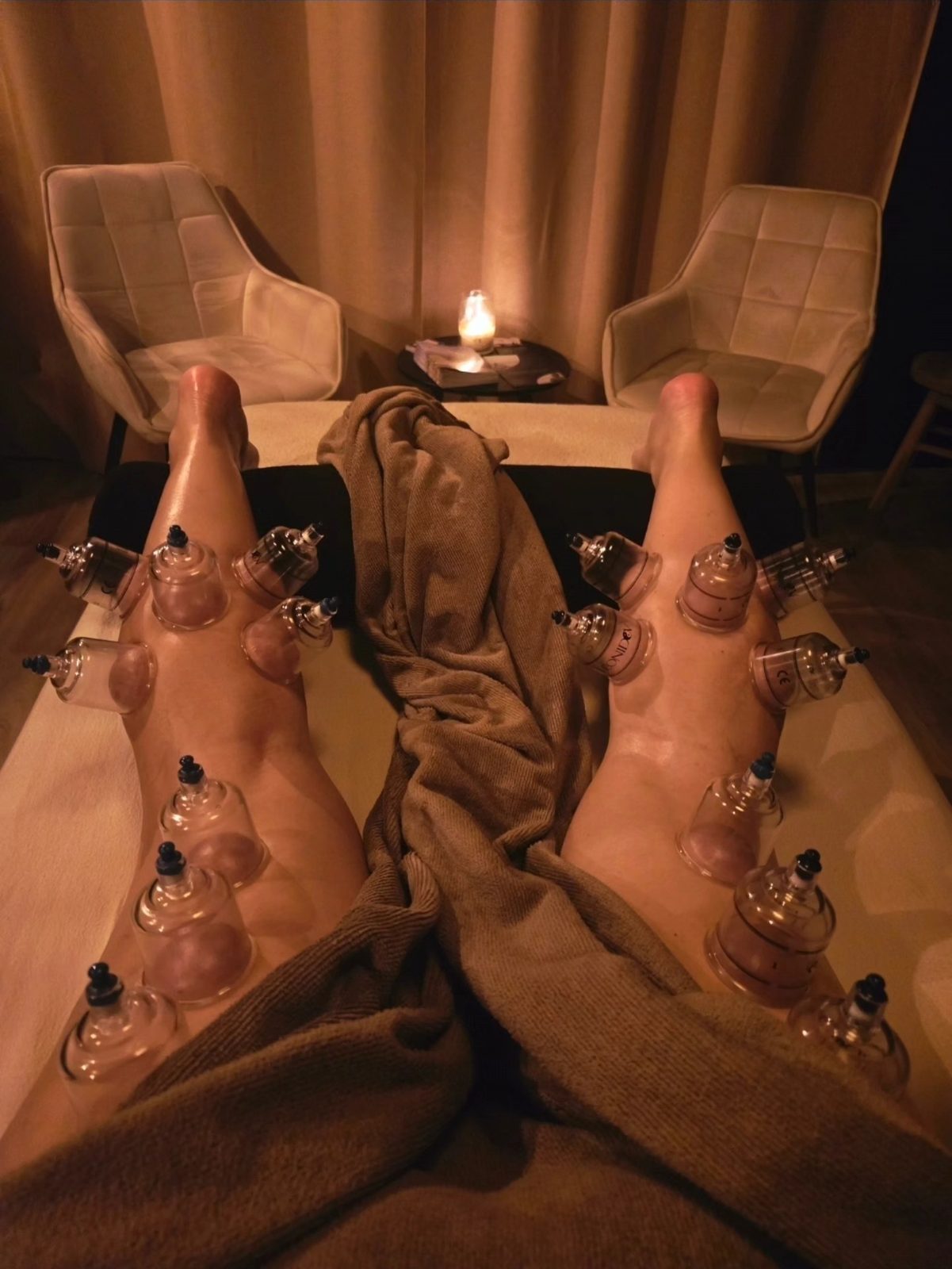 Glazen cups op beide benen tijdens een cupping anti-cellulite behandeling, bij kaarslicht